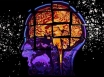 Australian researchers predicts risk of Alzheimer'